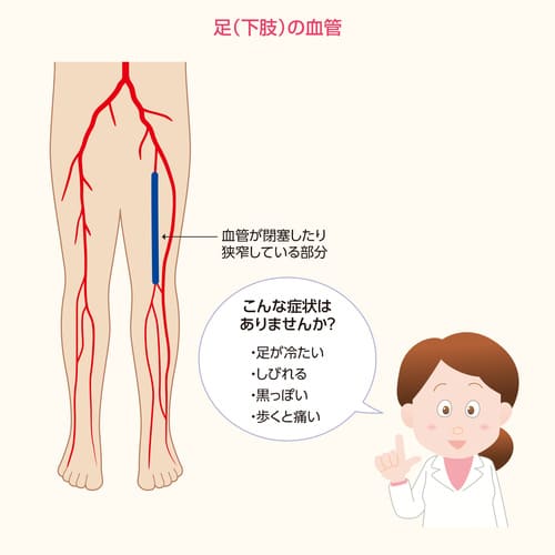 足（下肢）の血管