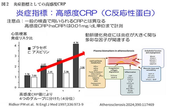 炎症指標としての高感度CRP（hsCRP）を示した図。hsCRPが高いほど心筋梗塞などの循環器イベントリスクが高く、動脈硬化の発症に炎症が関与することが示されている。